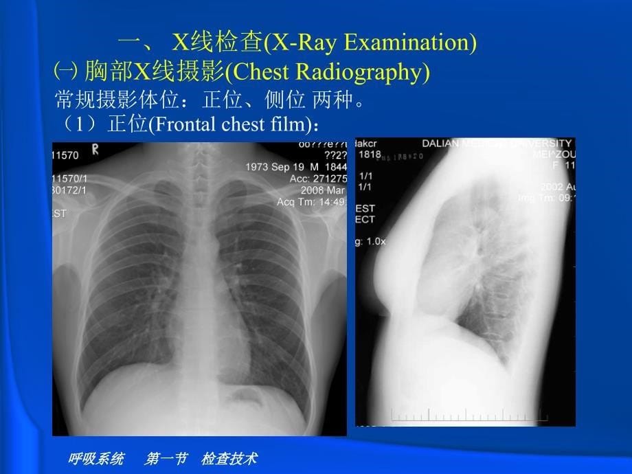 影像技术呼吸放射-正常表现剖析_第5页