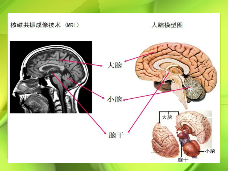 中枢神经系统正常影像解剖及颅脑基本病变新改解读_第4页