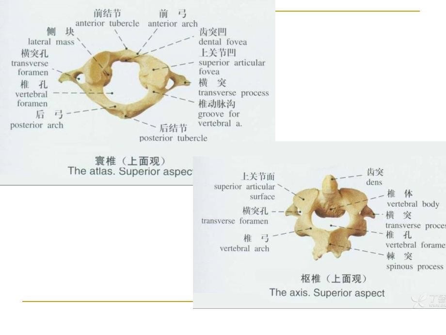 颈椎病X线诊断教程_第5页