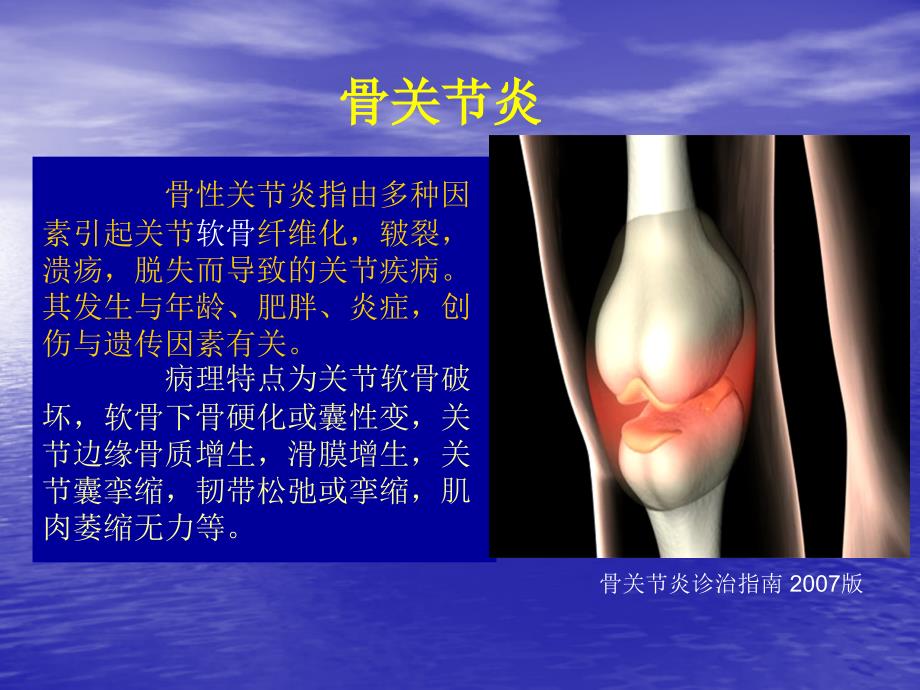 膝关节骨性关节炎的分级治疗6.3讲解_第3页
