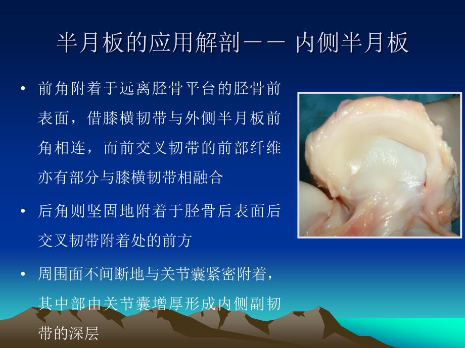 半月板解剖与mr诊断_第4页