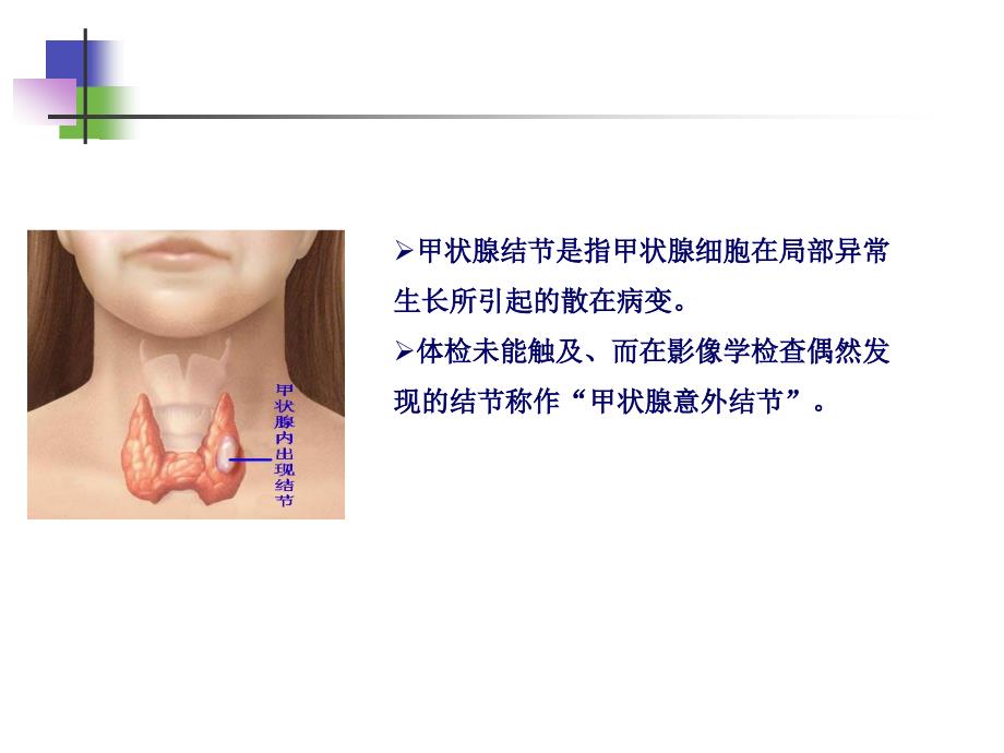 甲状腺结节的超声诊断及B超定位下细针穿刺技术汇编_第4页