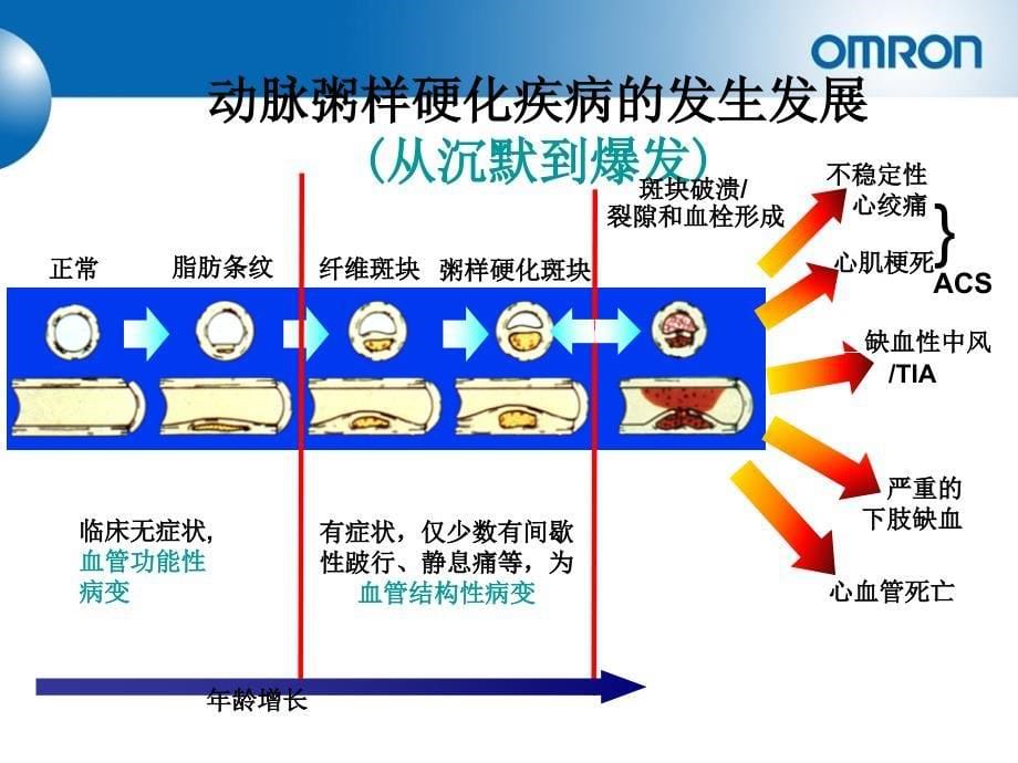 重要脉搏波传导速度 PWV讲解_第5页