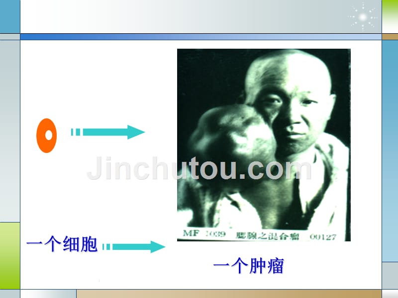 病理学肿瘤课件._第4页