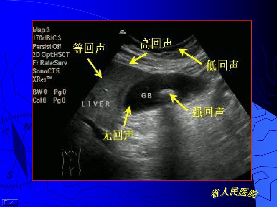 超声临床基础._第4页