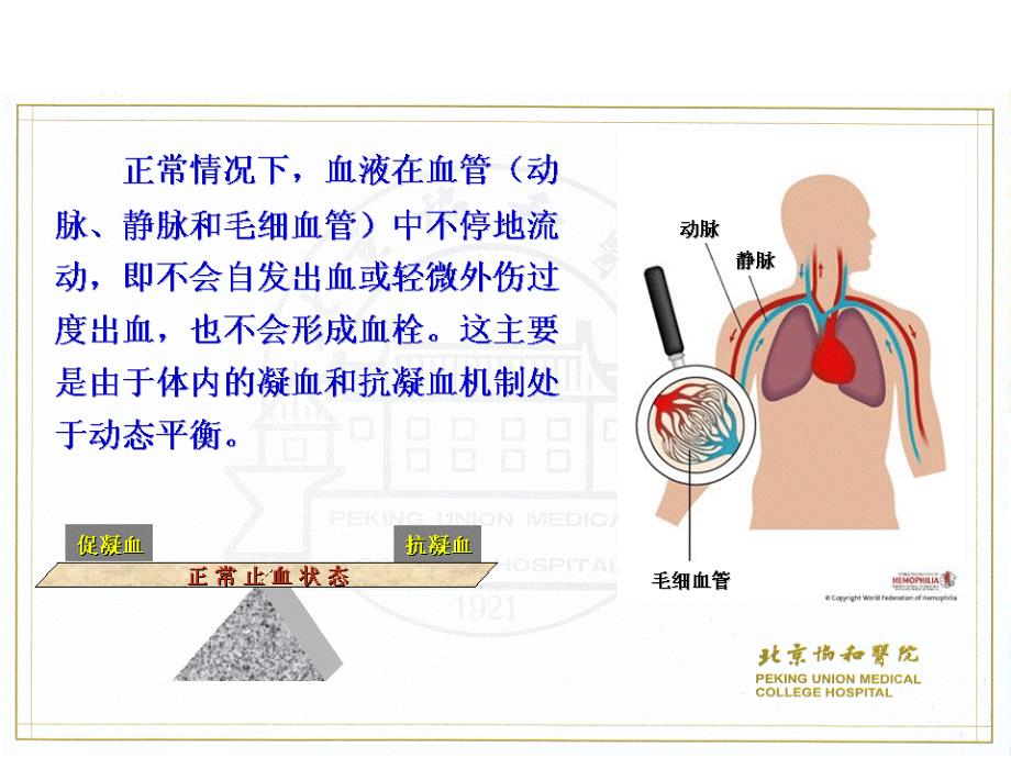 血友病病人的护理讲义_第4页