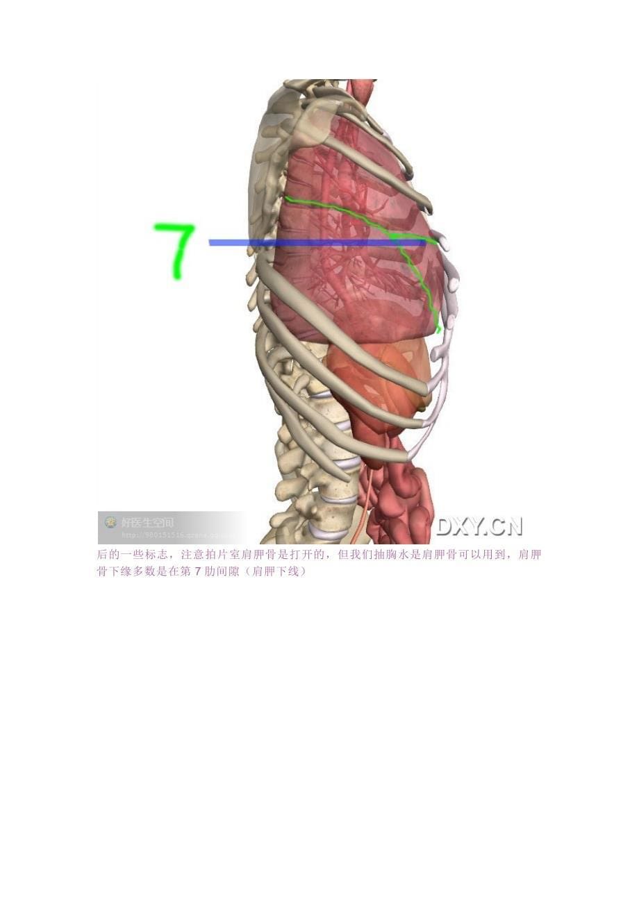胸腔穿刺定位定量影像讲解_第5页