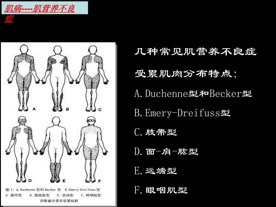 神经肌病概述汇编_第5页