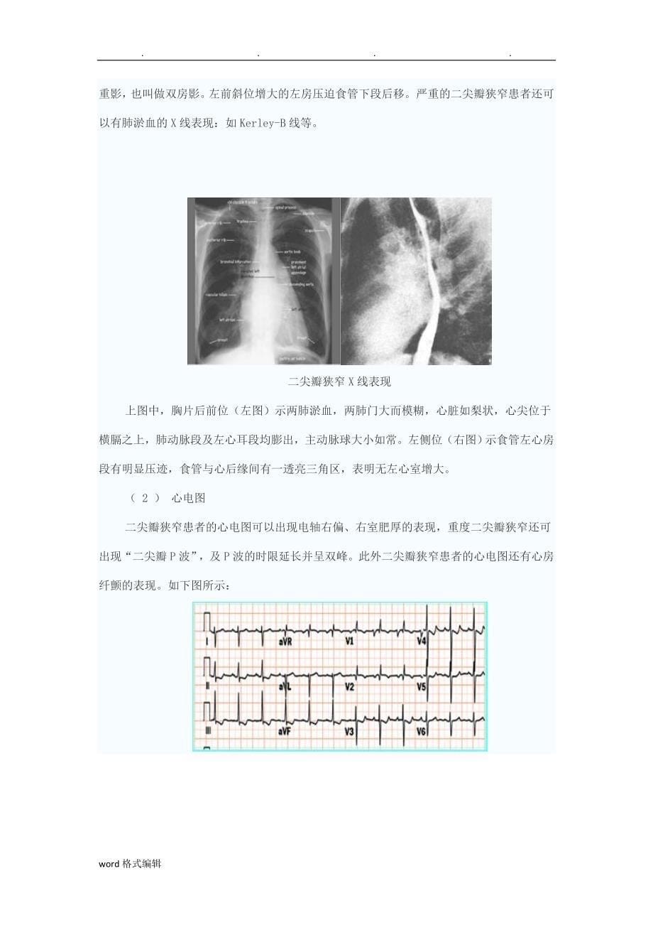 2心脏瓣膜病的病理生理与诊断_第5页