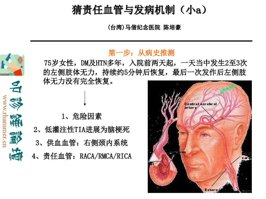 最新 从影像学梗死部位推测责任供血血管_第2页