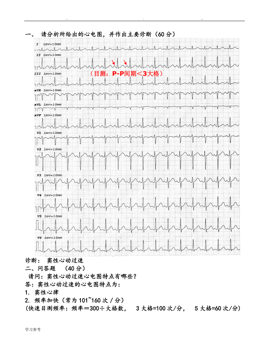 临床“三基”考试心电图复习题(图与答案)(1)_第4页