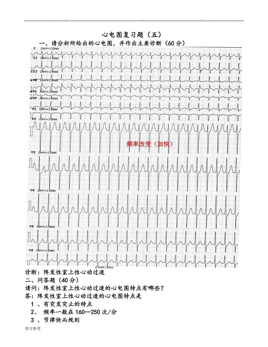 临床“三基”考试心电图复习题(图与答案)(1)_第5页