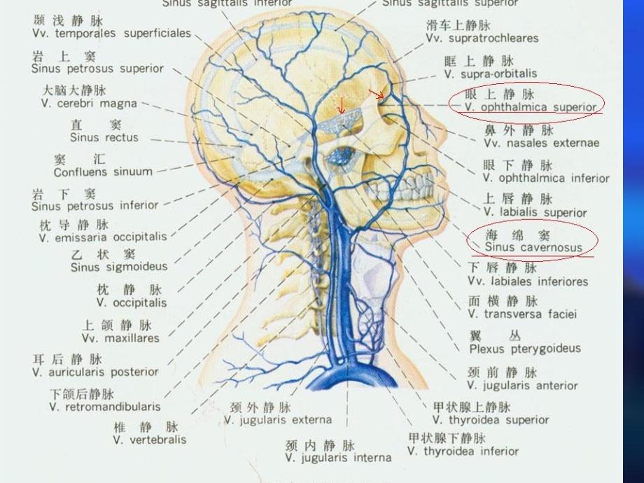 颈动脉海绵窦瘘超声诊断_第3页