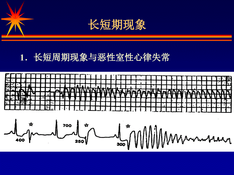 郭继鸿-心律失常心电图的几个特殊现象资料_第3页