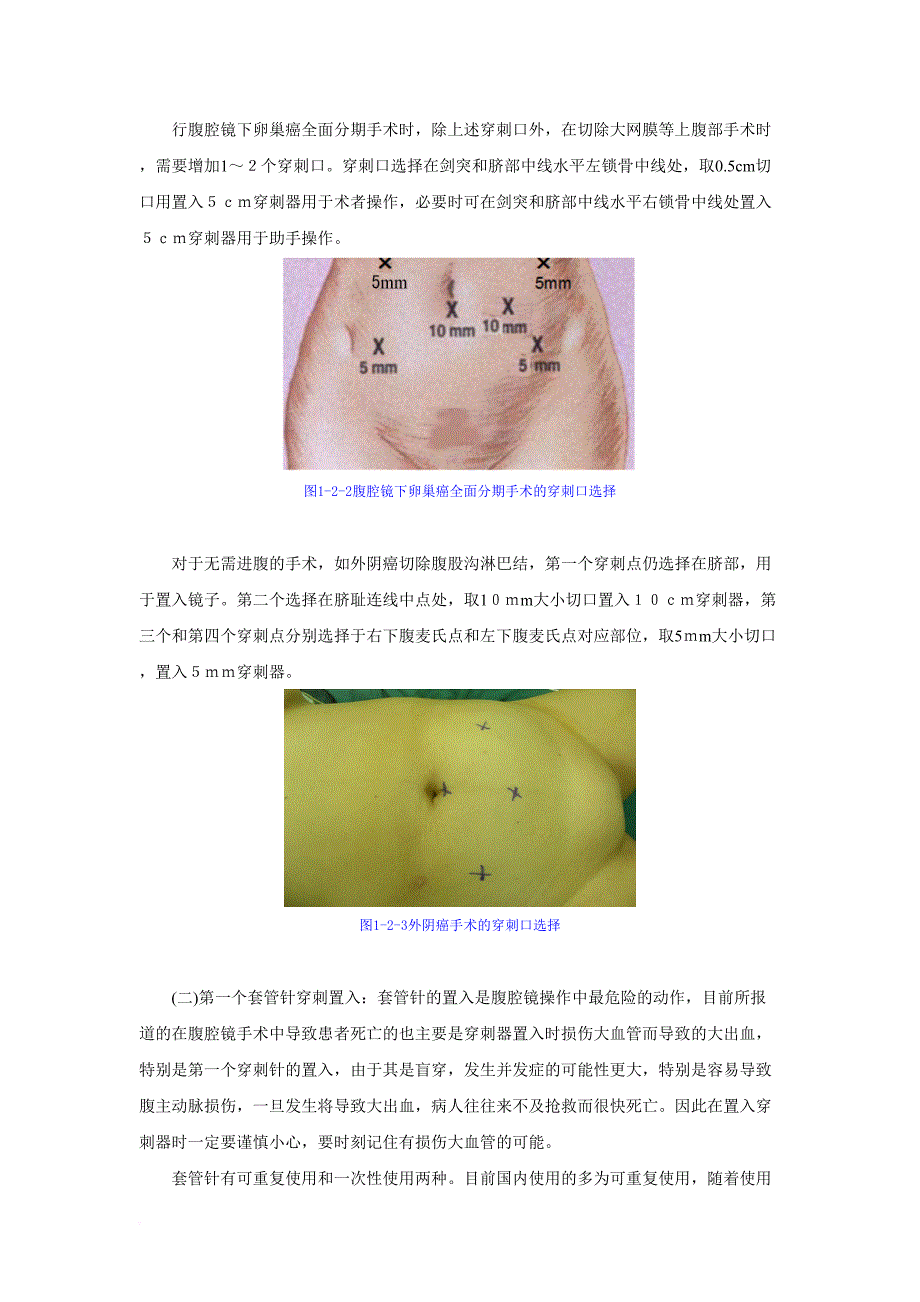 妇科腹腔镜手术技巧.doc_第4页