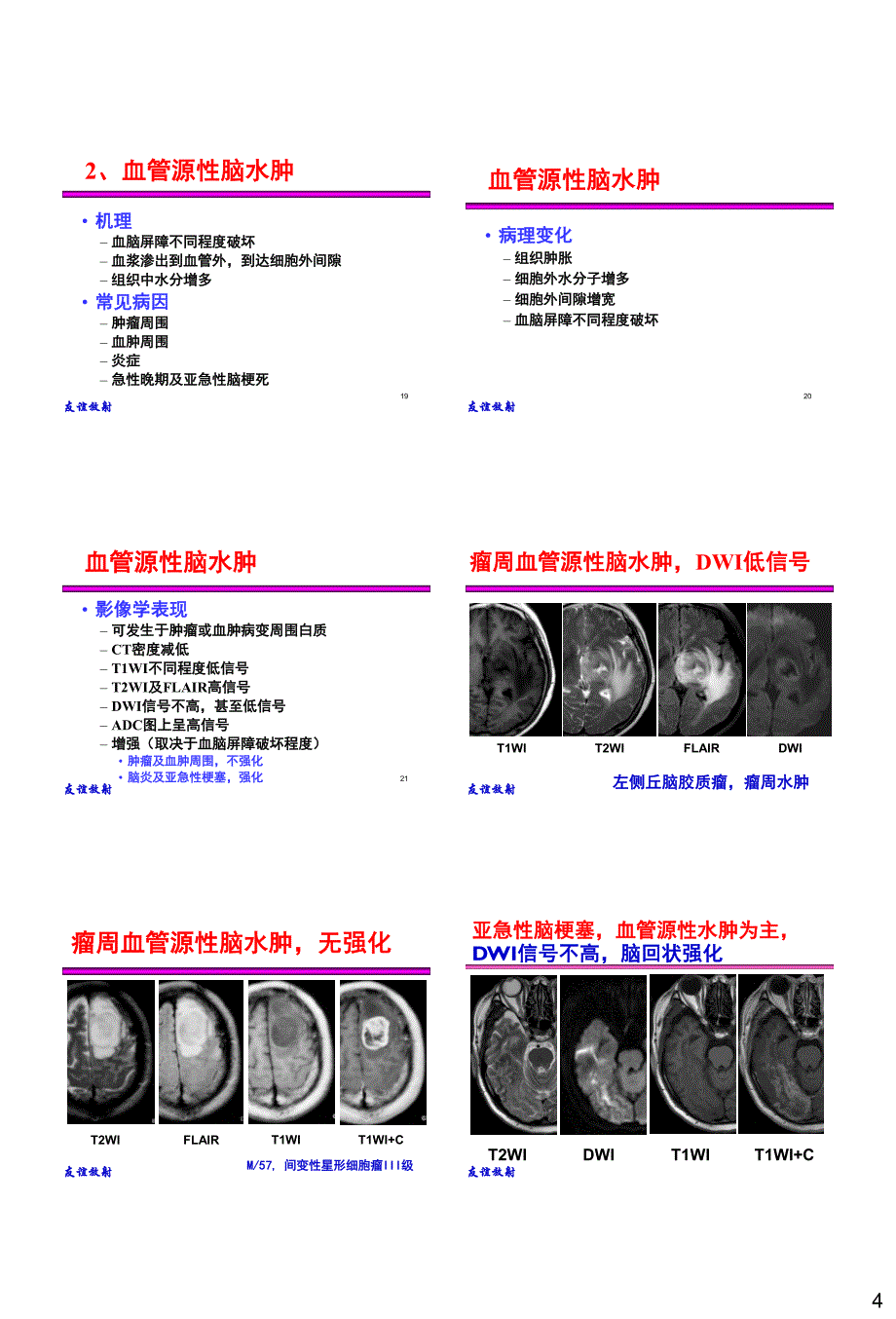 15. 基本病变的mri信号分析：水肿、坏死及纤维化_杨正汉_第4页