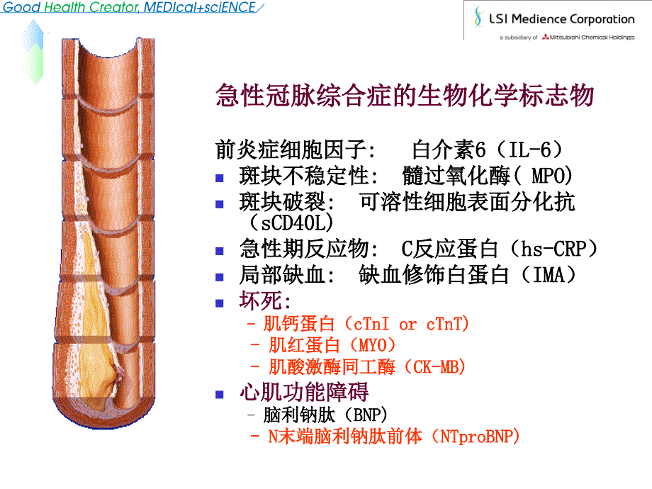 超敏ctni-&-ntprobnp检测的临床应用_第2页