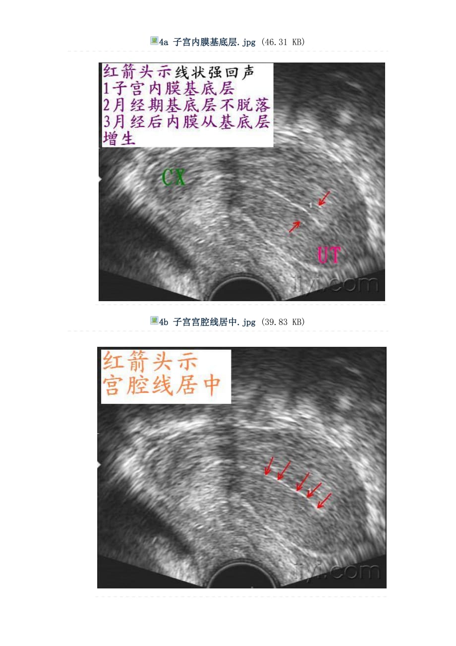 正常子宫和卵巢图片集_第3页