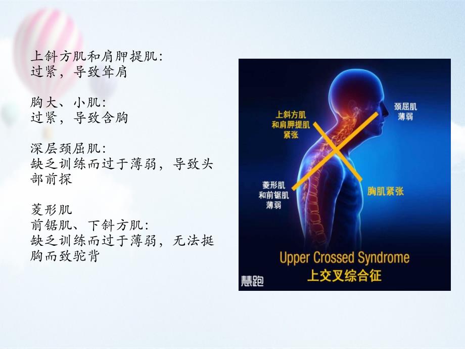 上交叉综合征资料_第4页