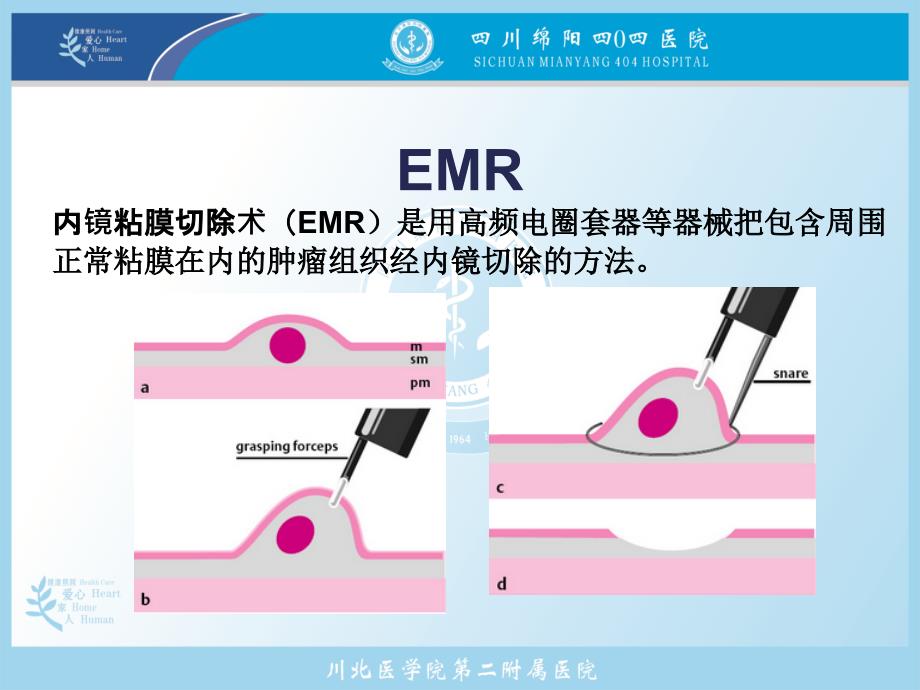 内镜下emr资料_第1页