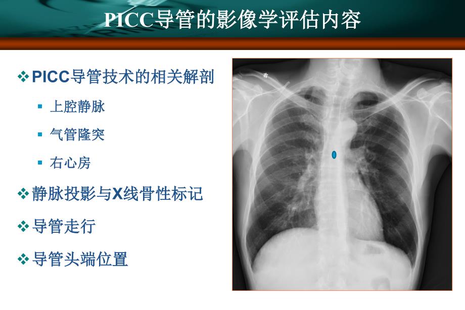 导管的影像学定位--资料_第3页