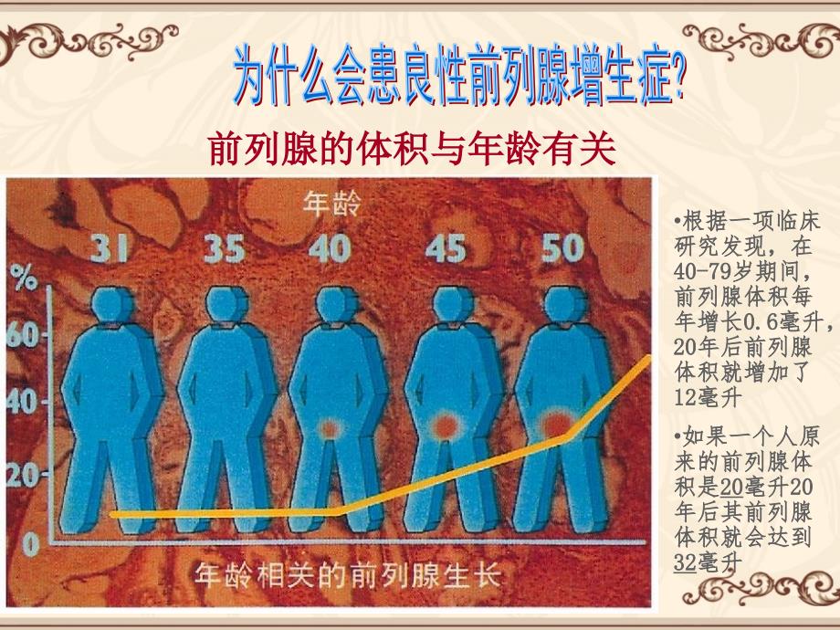 良性前列腺增生及治疗ppt_第4页