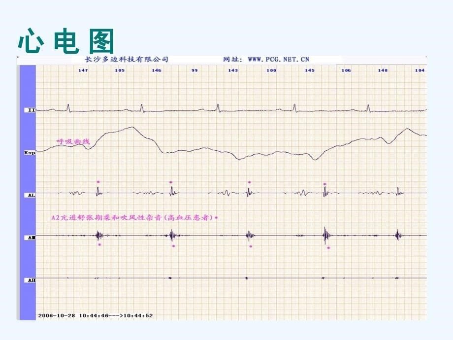 《折线统计图》课件2_第5页