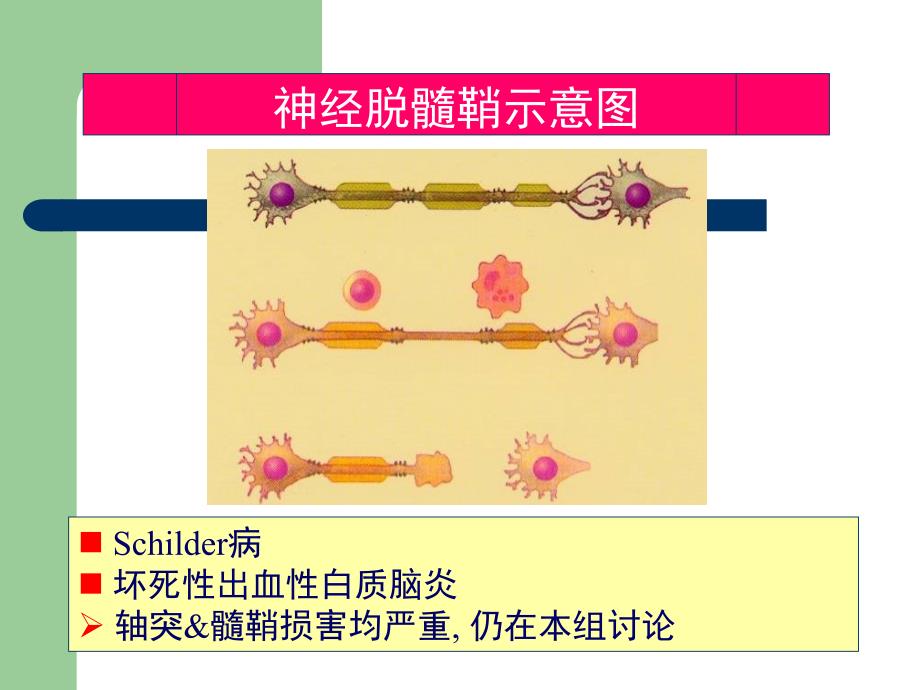 多发性硬化临床诊治_第4页