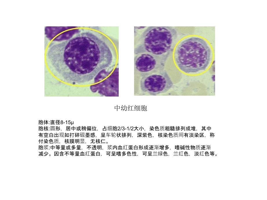 常见血液学图谱资料_第4页