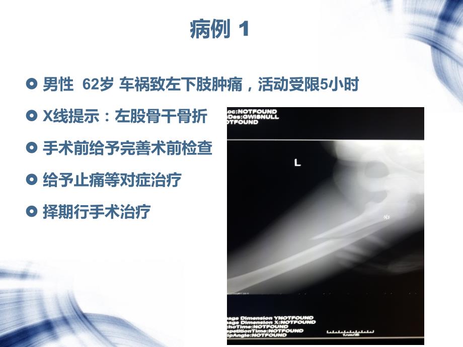 骨科脊柱及关节创伤围手术期镇痛治疗病例分享_第2页