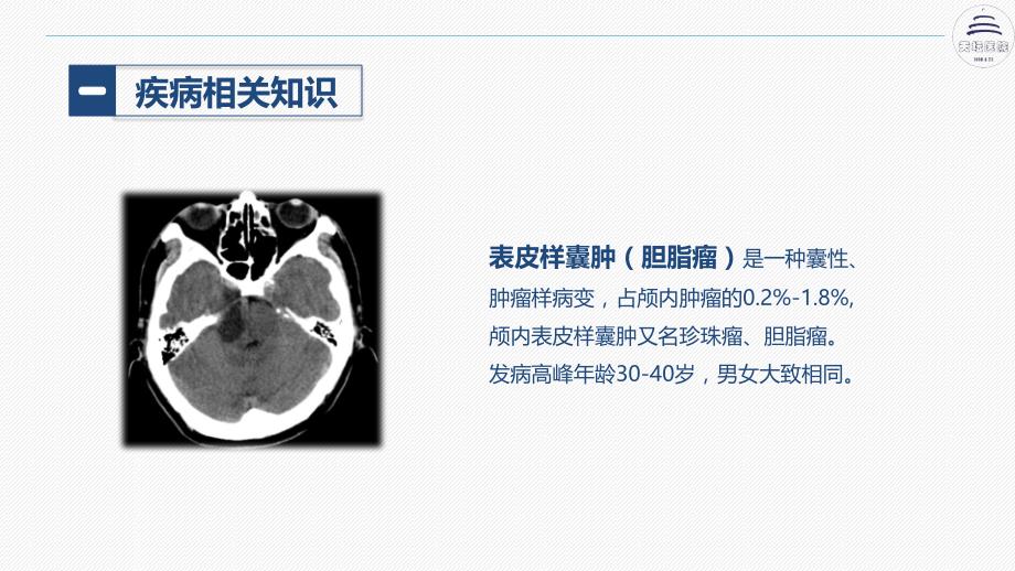 颅内表皮样囊肿患者护理查房_第4页