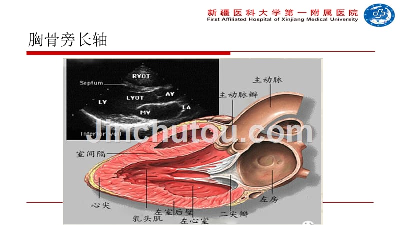 重症超声与血流动力学资料_第4页