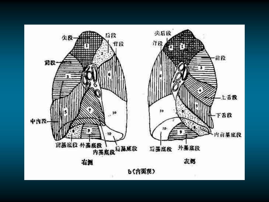 肺的x线解剖资料_第4页
