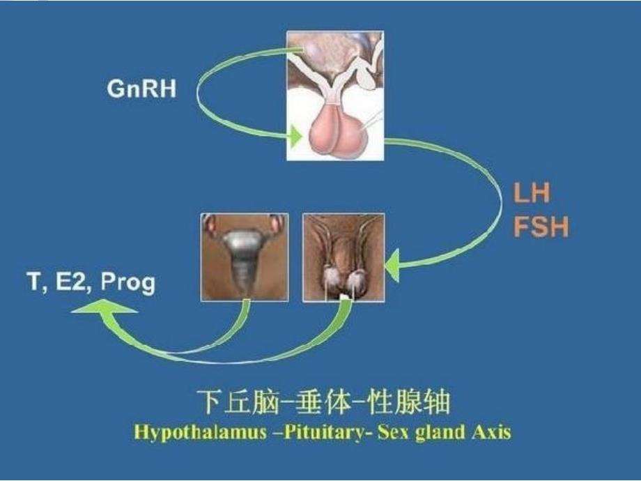 内分泌常见疾病与常用试验_第4页