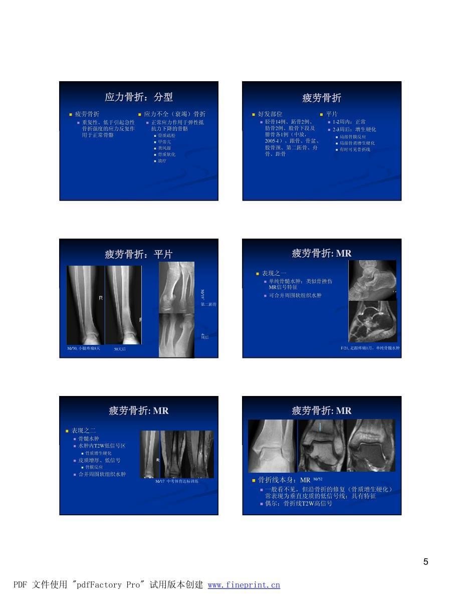 骨髓mri评价-郑卓肇资料_第5页