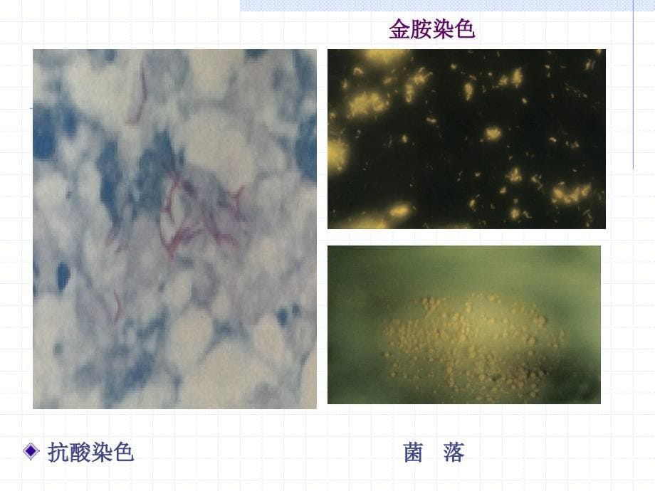 医学微生物学电子课件14分枝杆菌_第5页