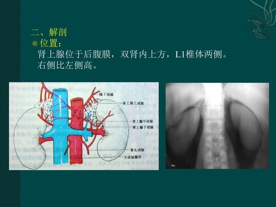 肾上腺占位病变影像诊断_第5页