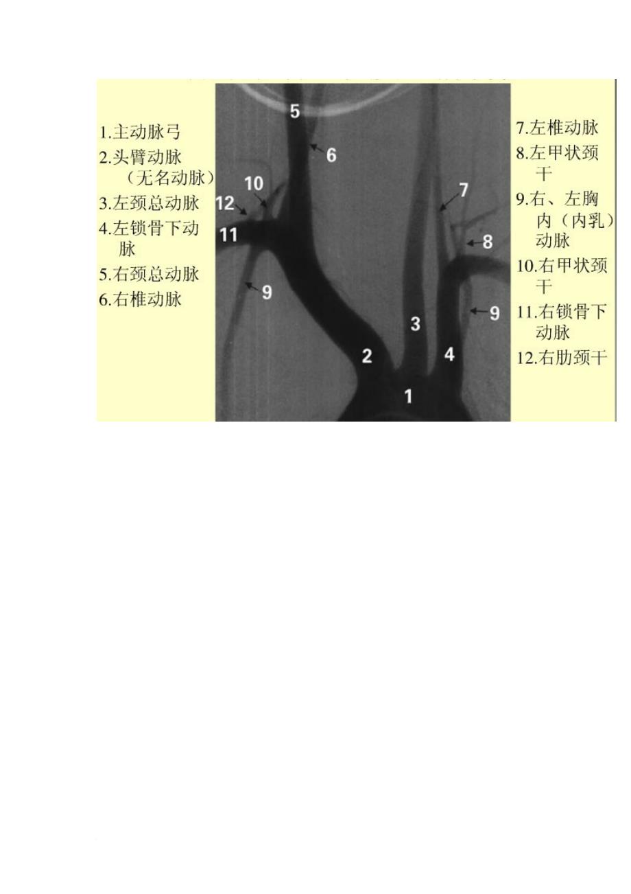 脑血管造影图片详解.doc_第3页