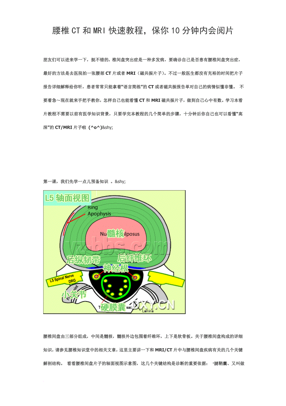 腰椎ct和mri快速教程-保你10分钟内会阅片.doc_第1页