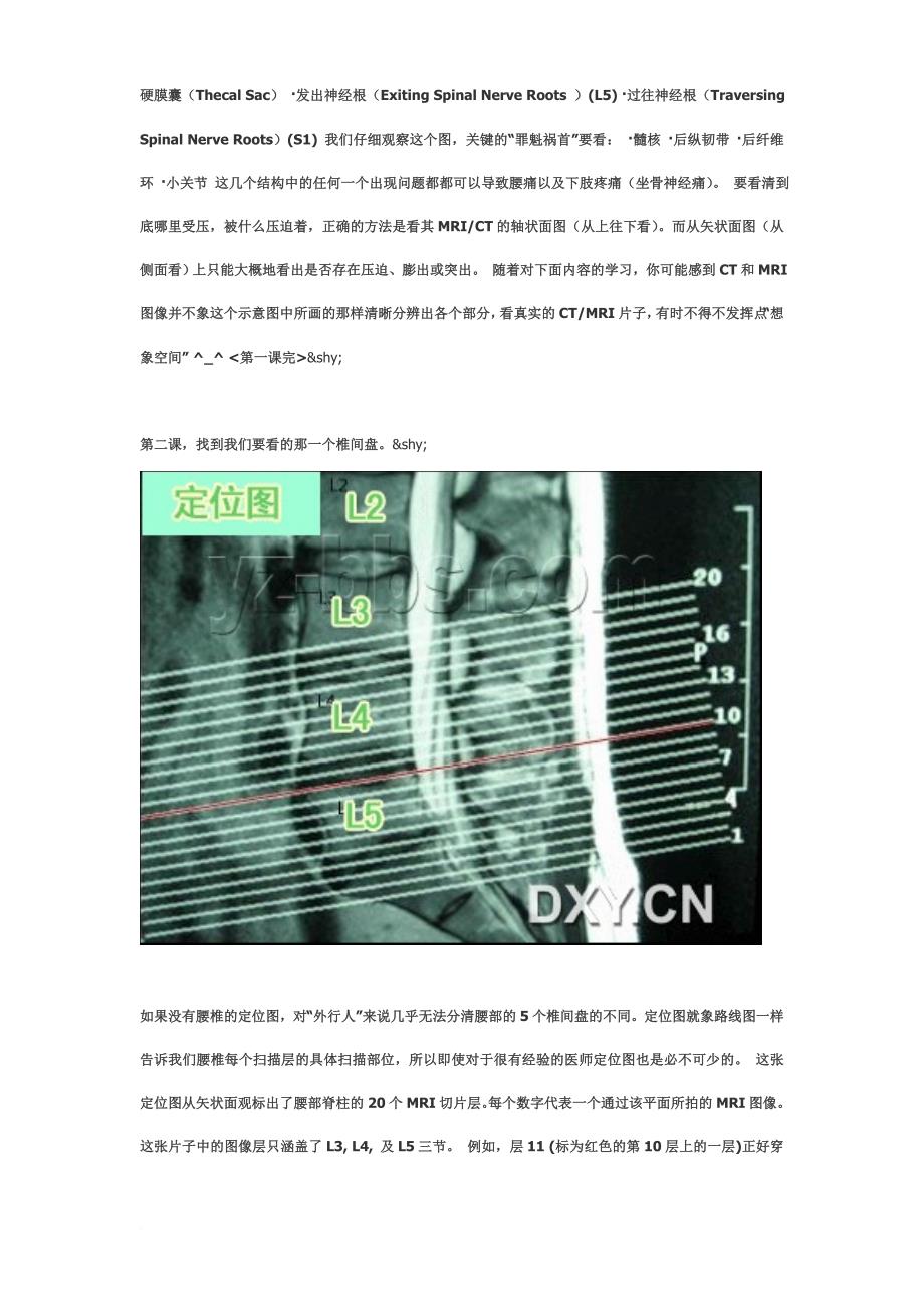 腰椎ct和mri快速教程-保你10分钟内会阅片.doc_第2页