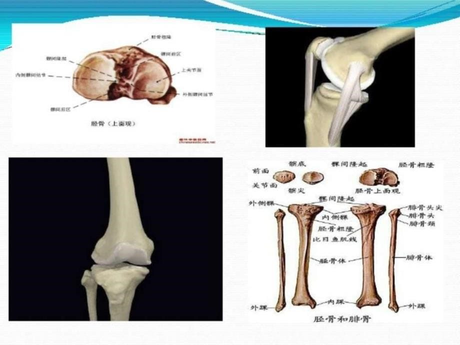 胫骨平台骨折的护理.ppt_第5页