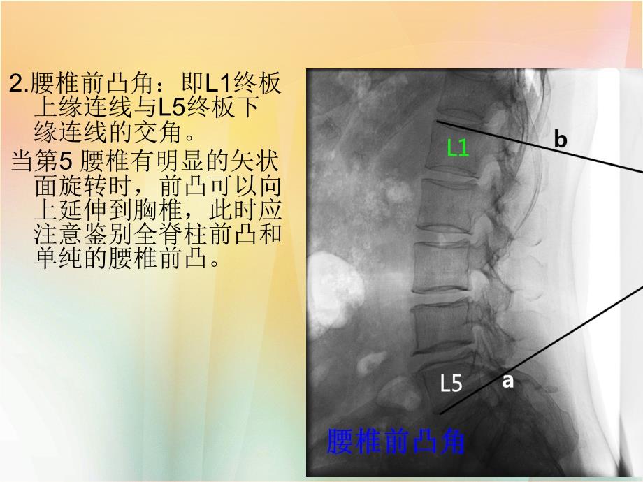 骨科常用的一些角度参数20131127资料_第4页