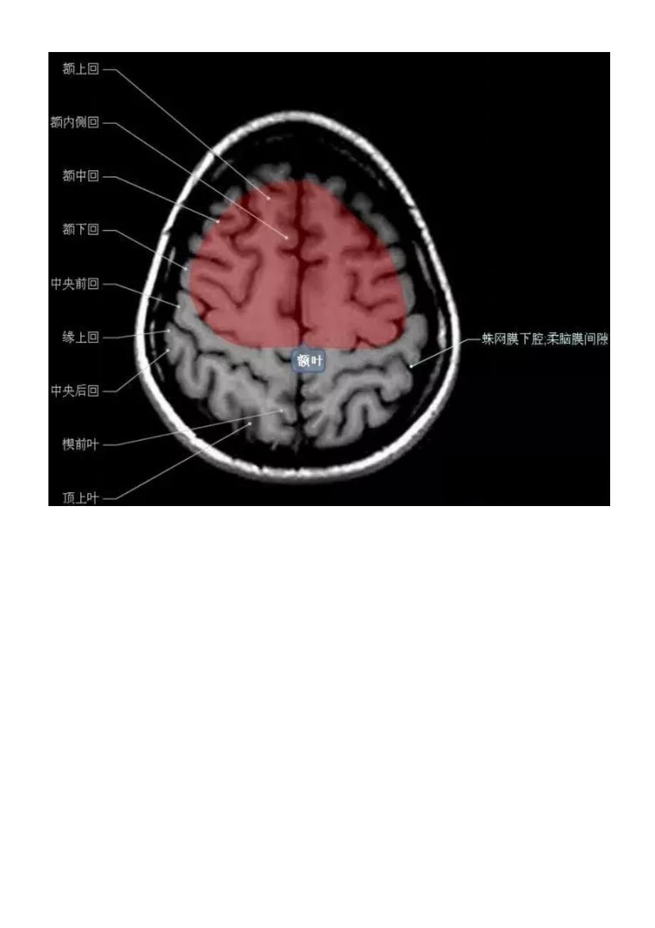 正常颅脑磁共振图示资料_第3页