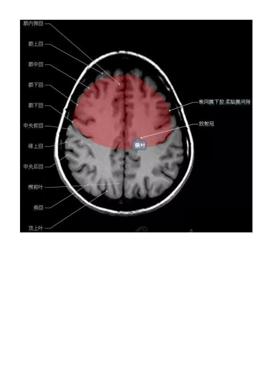 正常颅脑磁共振图示资料_第5页