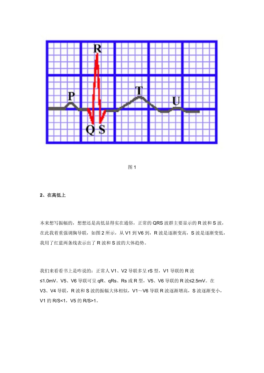 心电图qrs波群的五种.doc_第2页