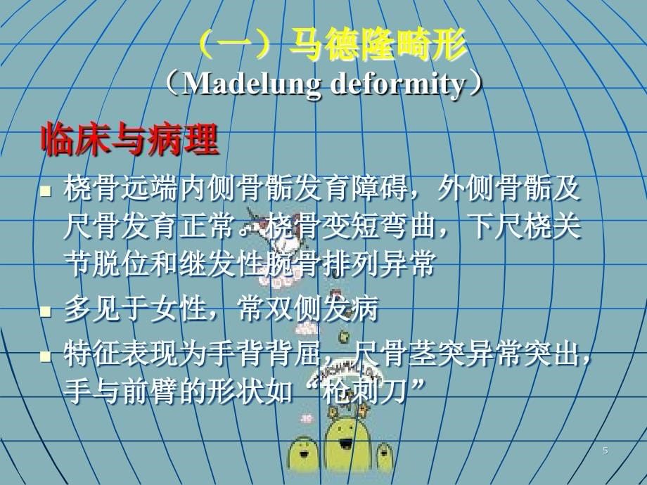 骨和关节发育畸形王培源OK_第5页