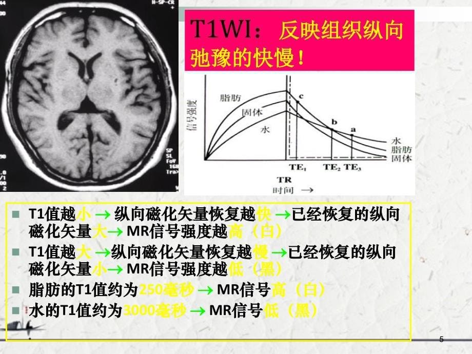 人体正常组织以及病理组织MR信号表现的特点_第5页