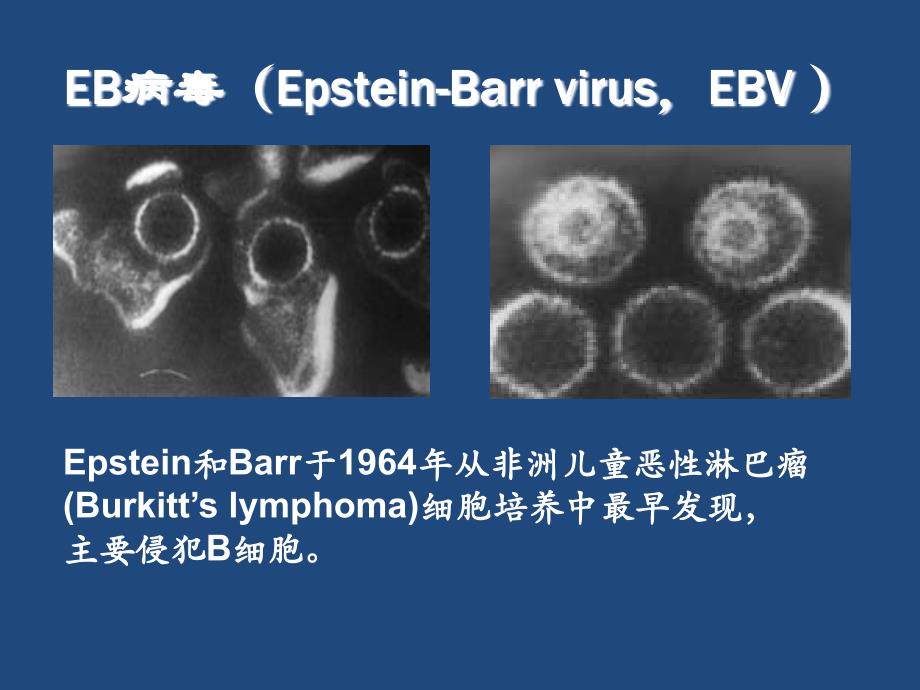 儿童EB病毒感染儿科业务学习_第4页