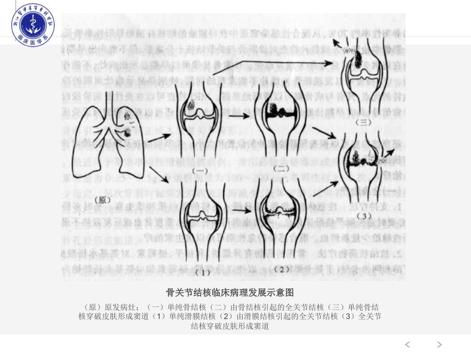 外科学6.4-骨与关节结核_第4页