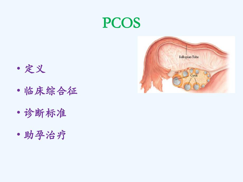 PCOS与异常子宫出血_第1页